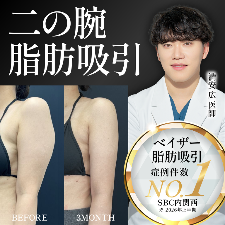 【熊本】二の腕の脂肪吸引なら満安医師にお任せ!