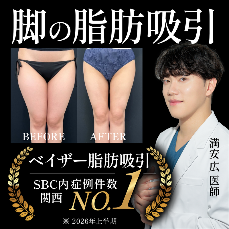 【足の脂肪吸引】太もも・ふくらはぎの太さでお悩みの方へ!SBC熊本院で解決できます♪