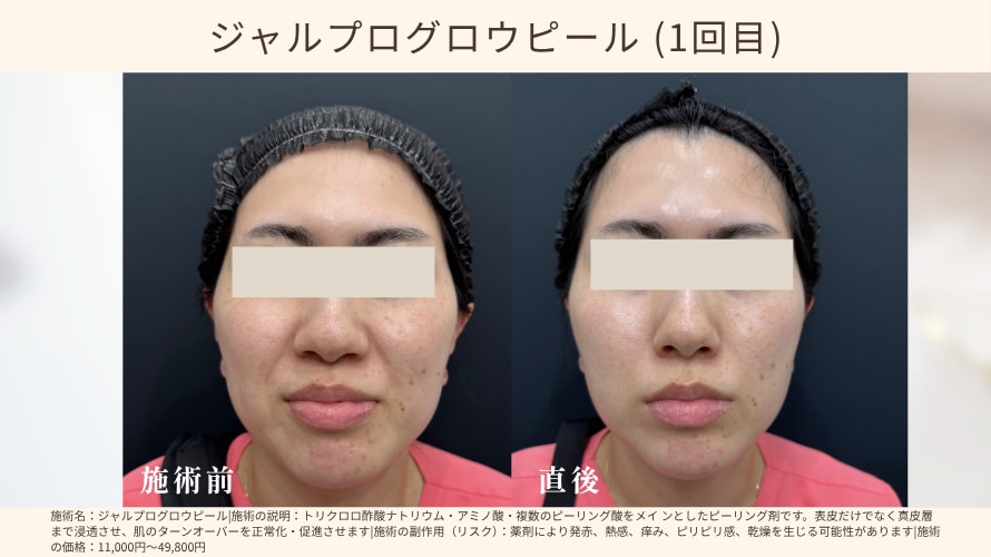 症例写真はこちらです✨