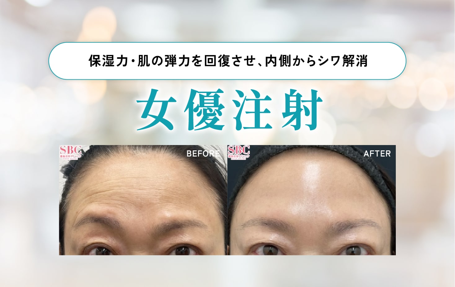 女優注射