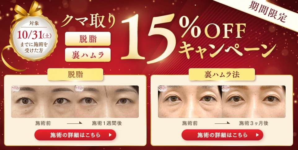 定価＆モニター15%オフ‼️