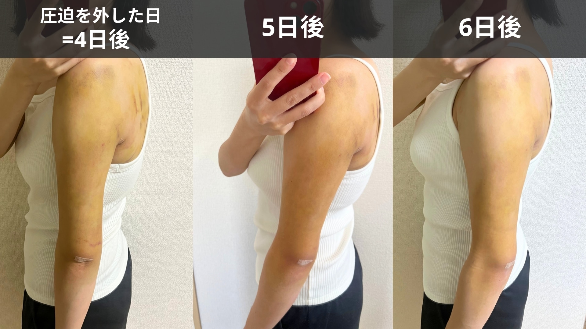 ダウンタイム公開
