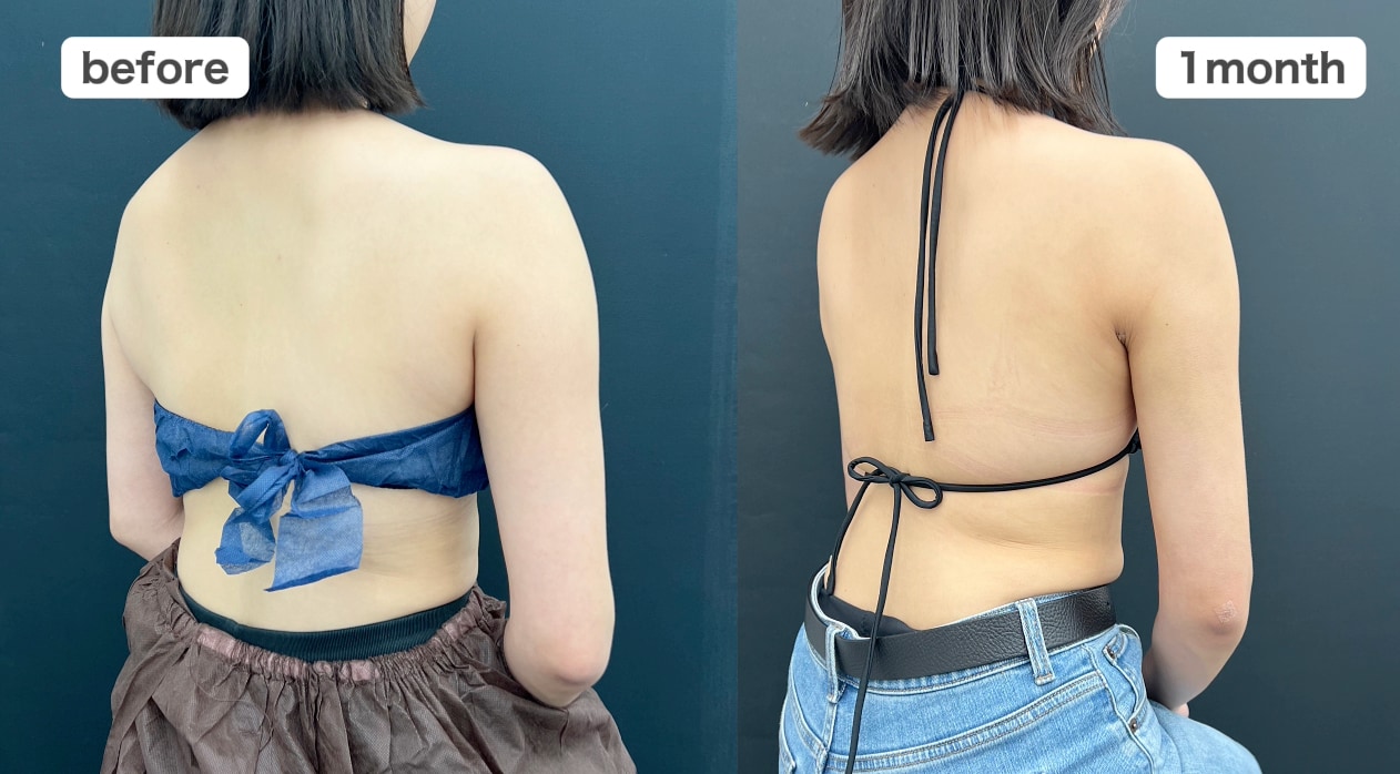 before・after