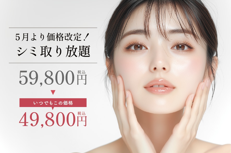 シミ取り放題が価格改定！