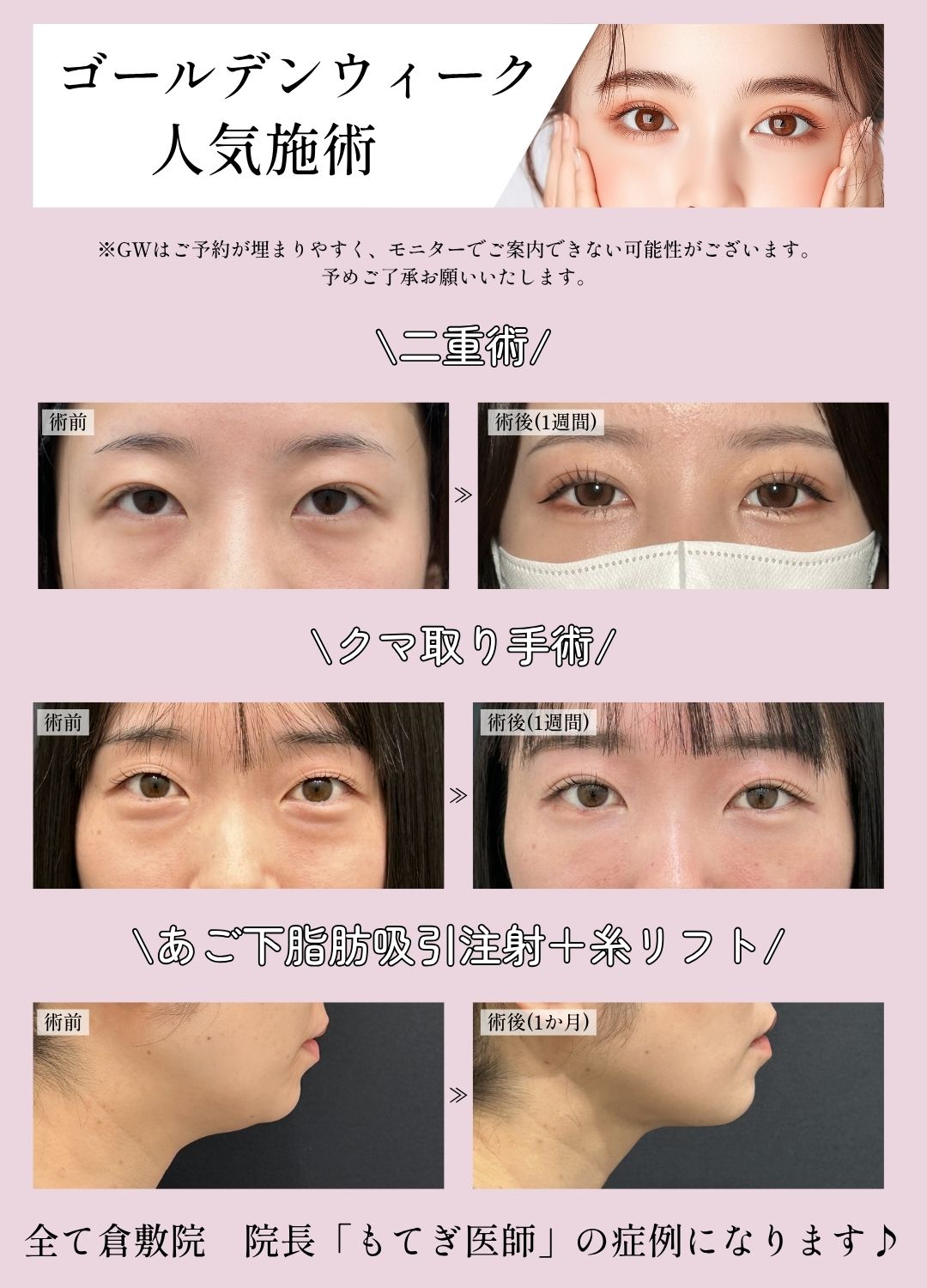 部分モニター募集中！