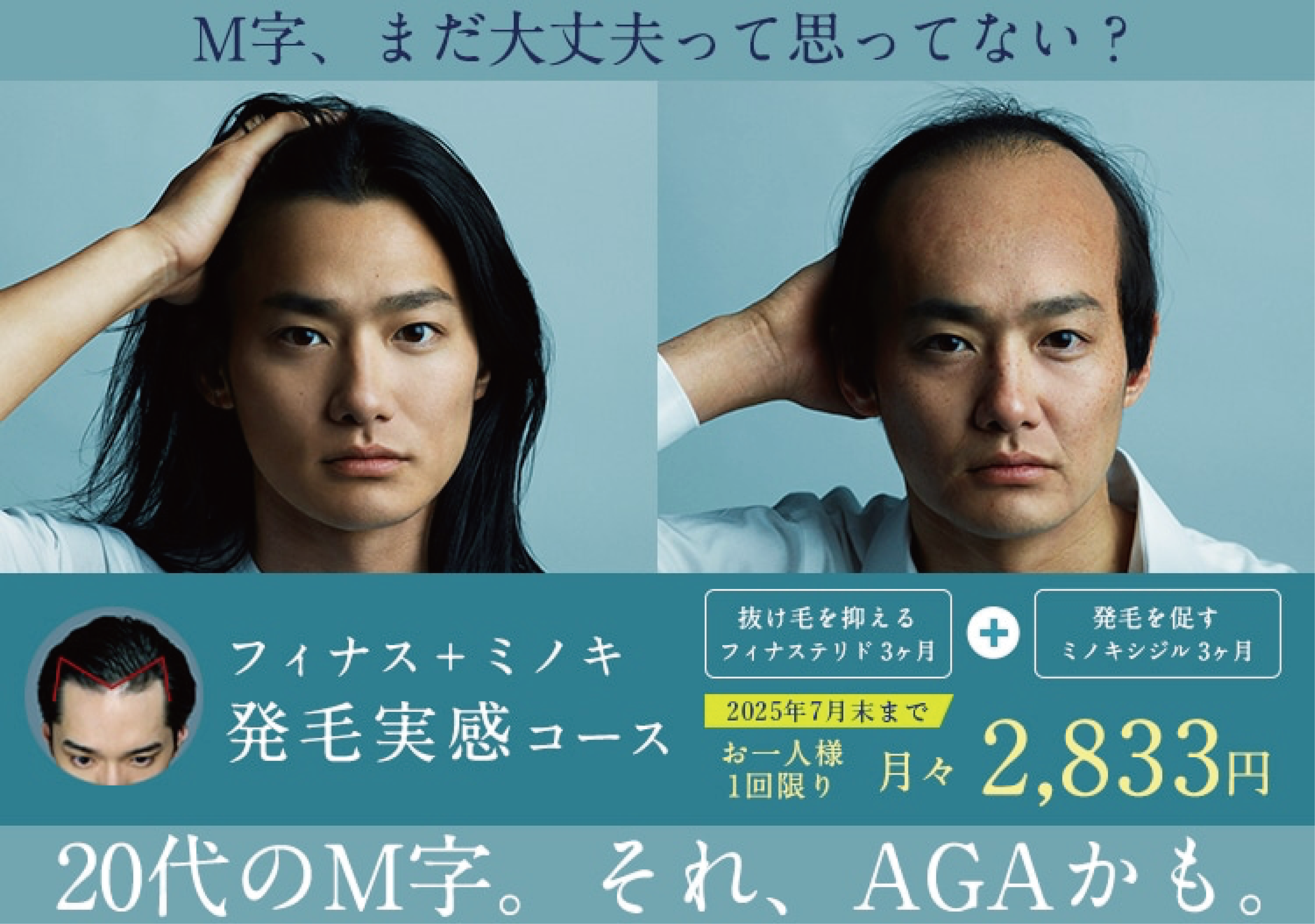 AGAの初回キャンペーン実施中!