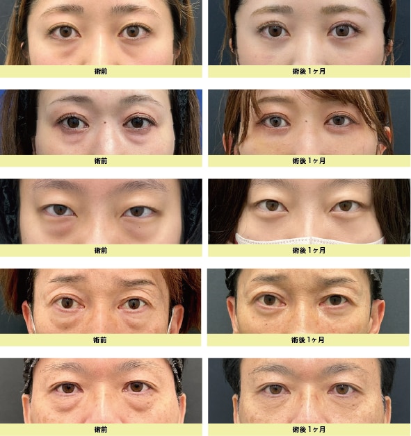 術後の変化をしっかり実感！