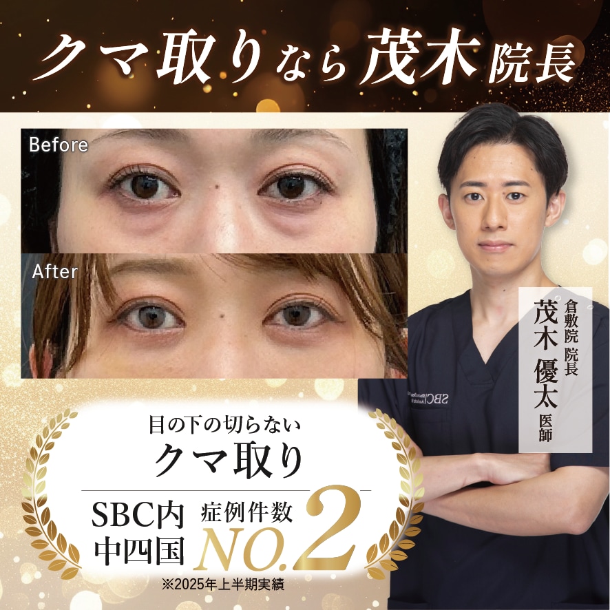 岡山・倉敷でクマ取りするならSBC倉敷院・院長の茂木医師にお任せください！