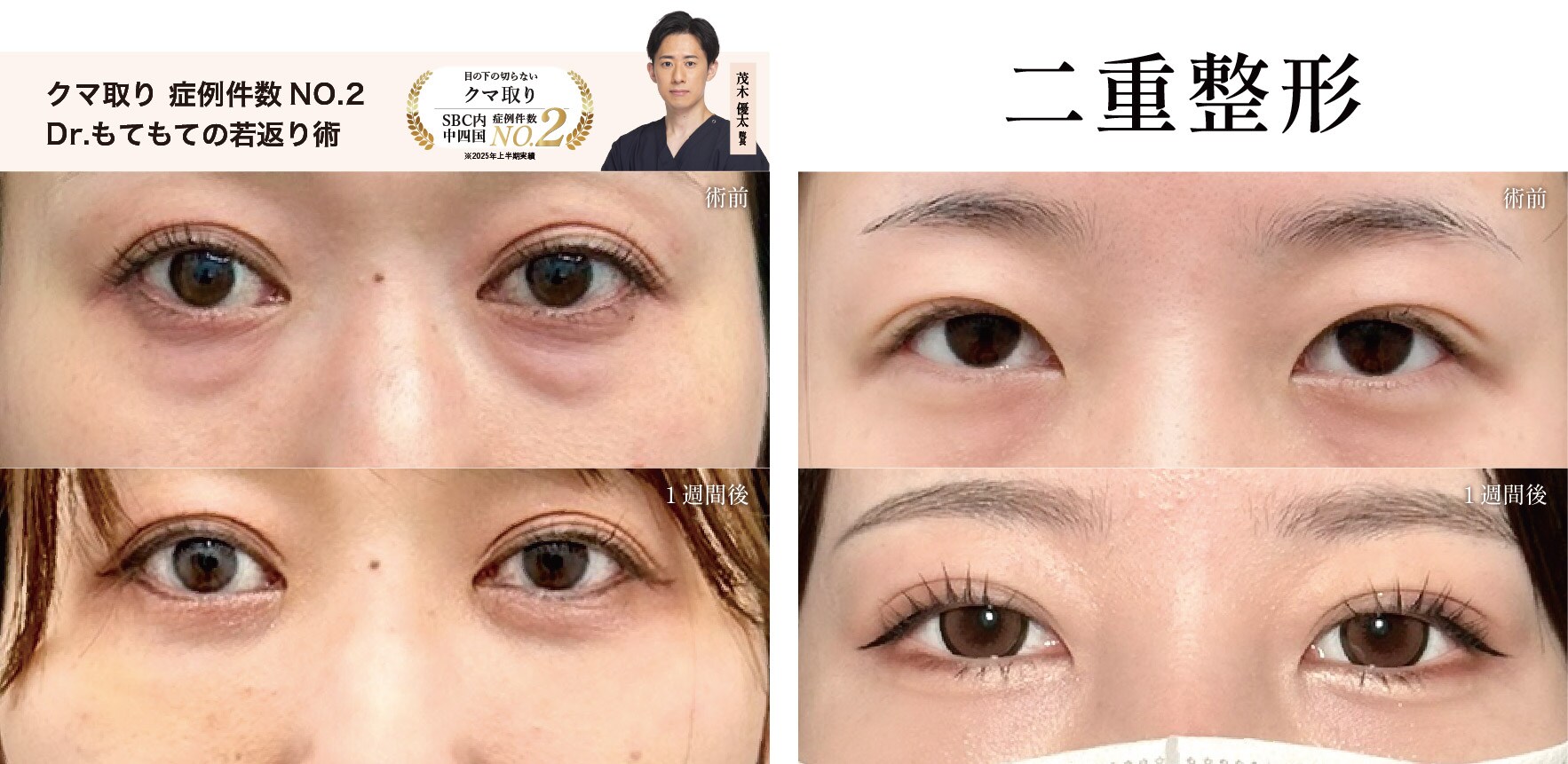 美容外科 NO.2「クマ取り/二重整形」