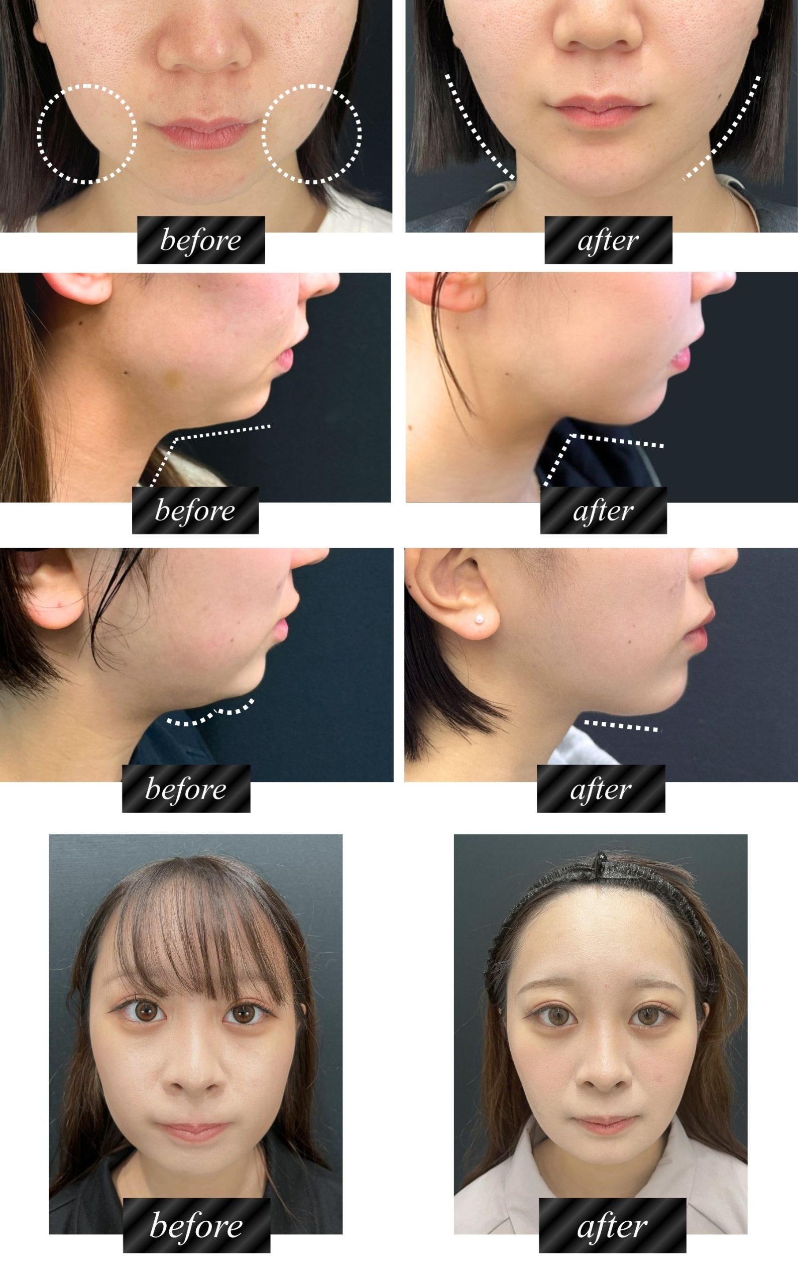 大久保医師の症例写真を紹介いたします。