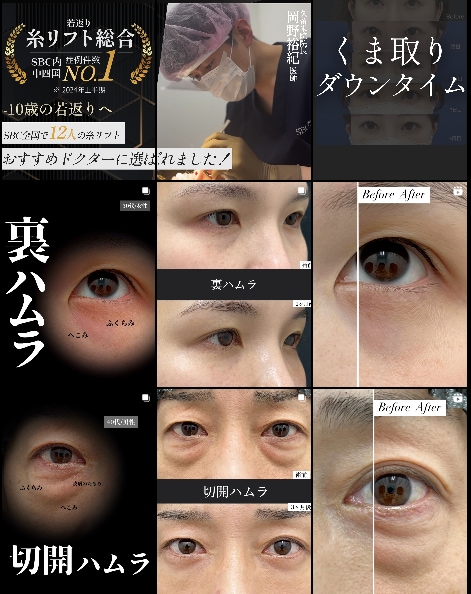 症例はこちら -  スペシャルセール
