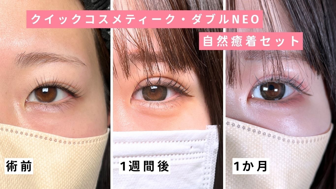 湘南美容クリニック 夏休みキャンペーン