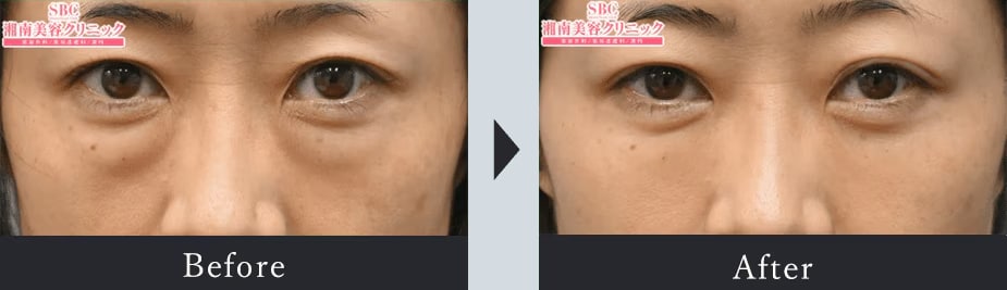 9月連休中の予約案内