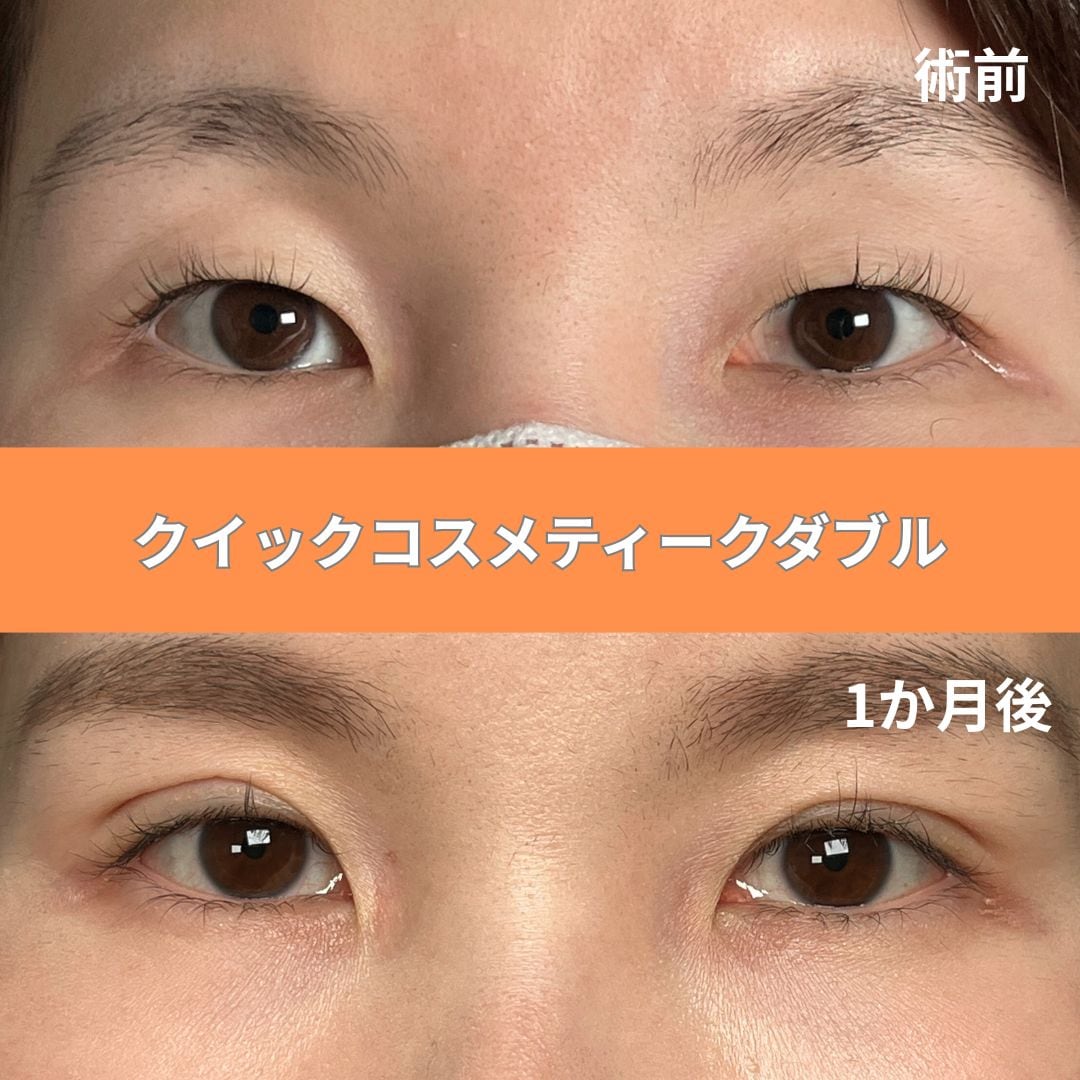湘南美容クリニック久留米院のカウンセリングルーム