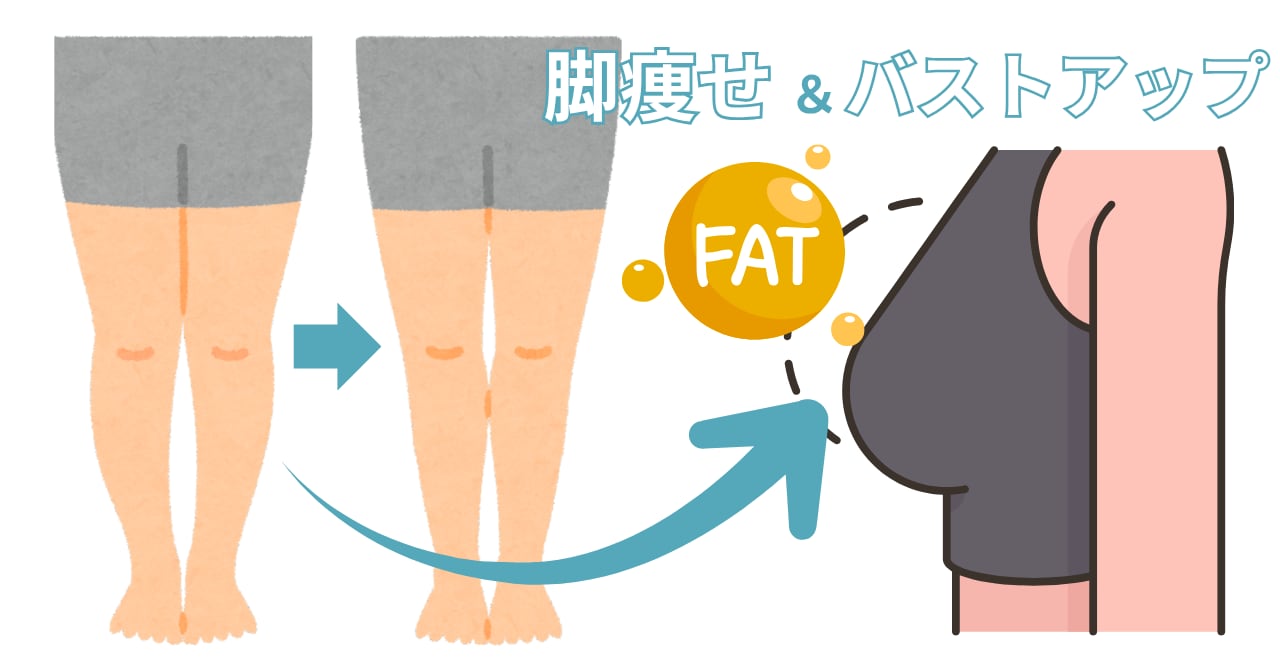 コンデンスリッチ脂肪注入豊胸とは