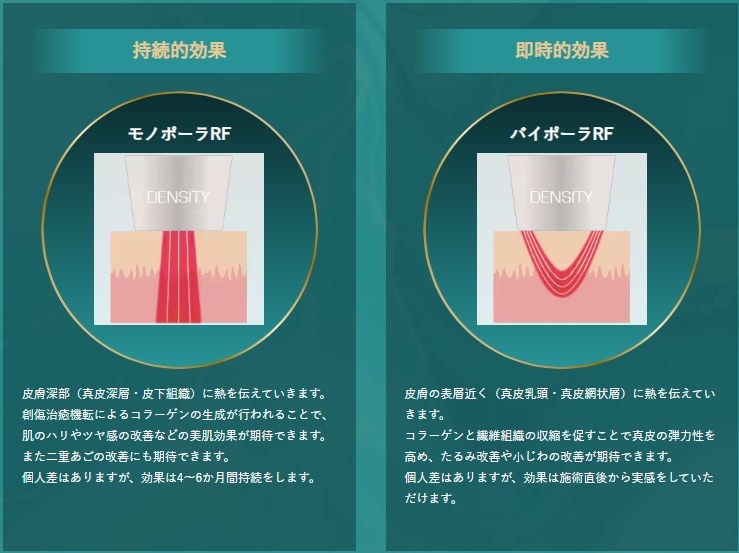 湘南美容クリニック久留米院のデンシティ施術画像