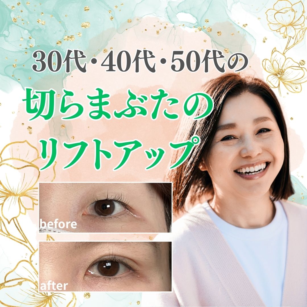 【30代・40代・50代必見】切らないまぶたのリフトアップで若見え効果を実感！