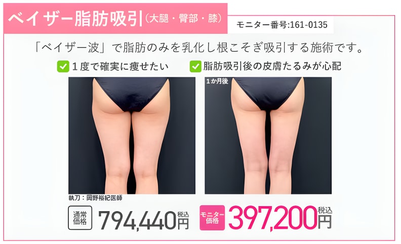 SBC久留米院の予約状況