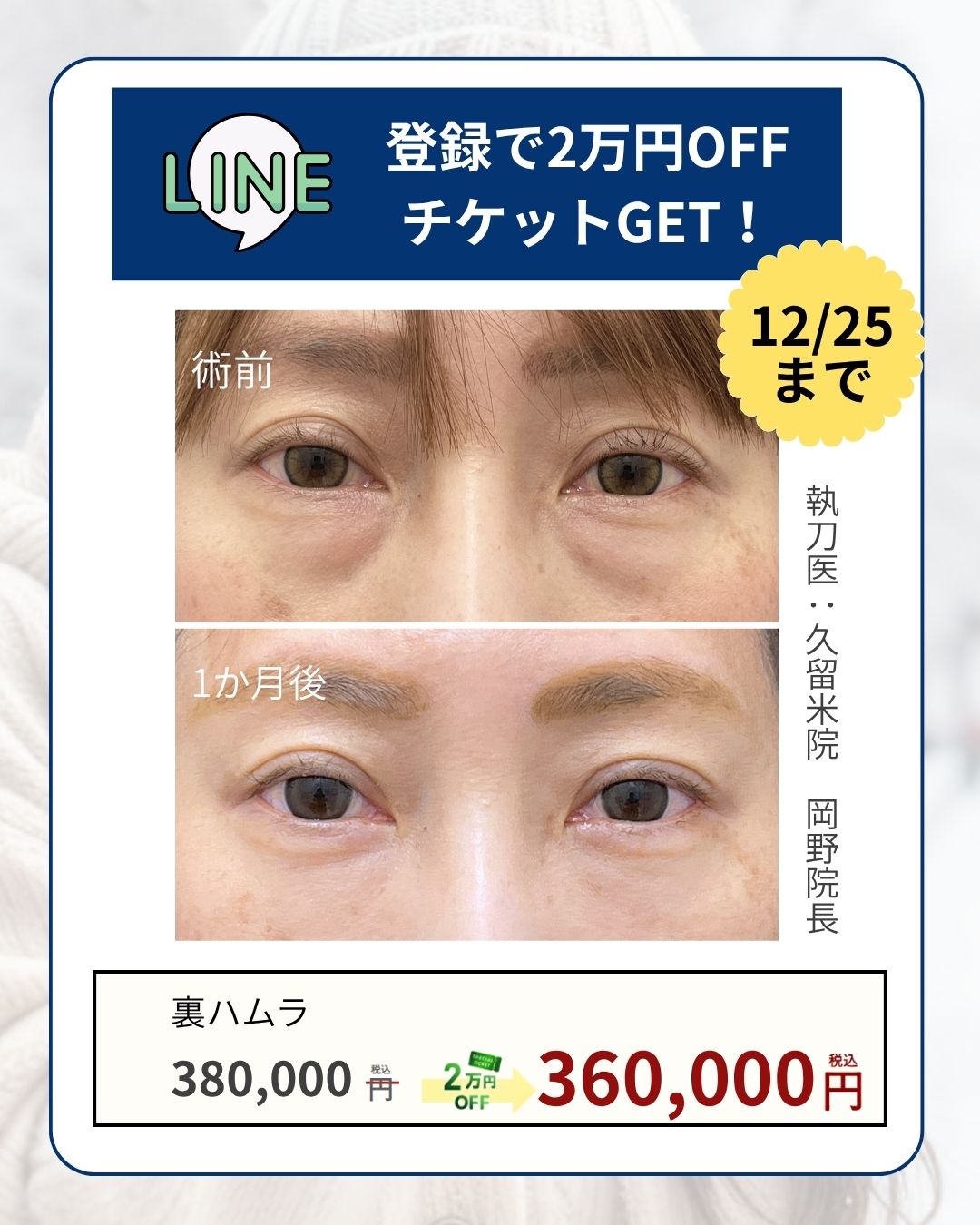 2万円OFFチケット