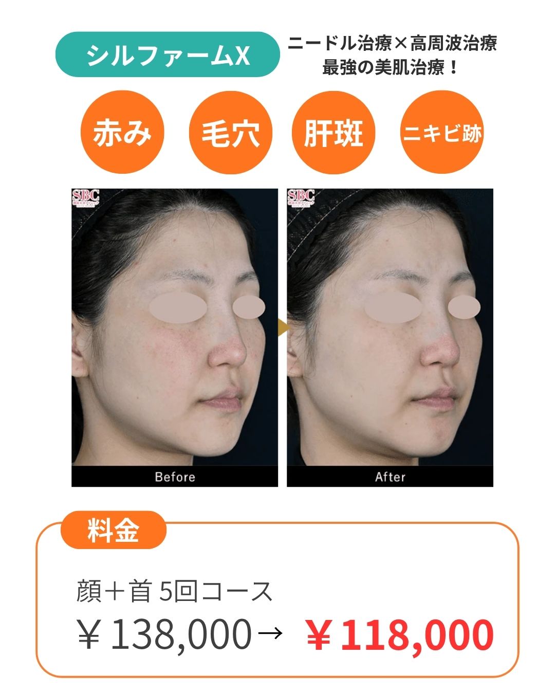 「女優水光3セット」⁈