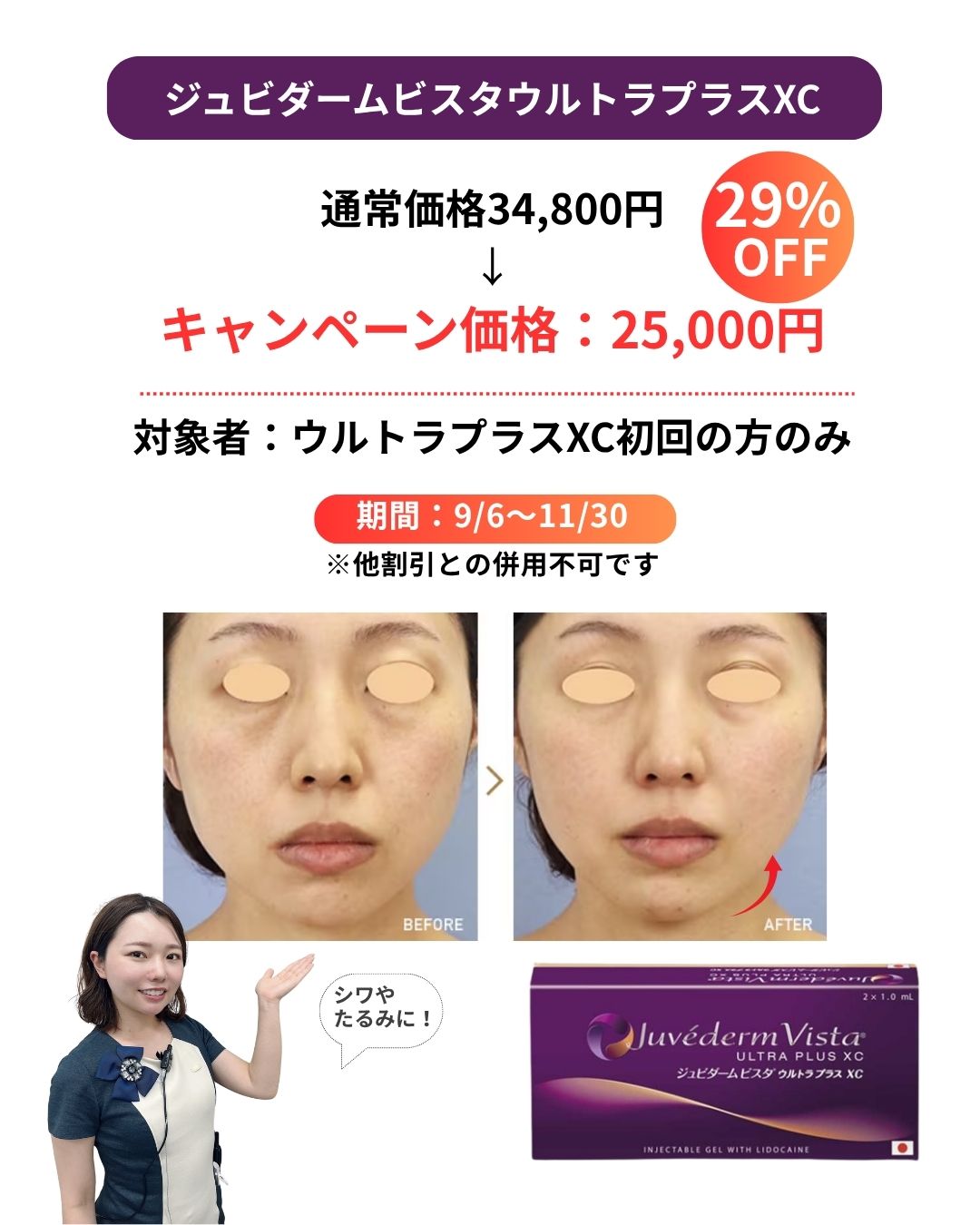 ジュビダームビスタウルトラプラスXC
