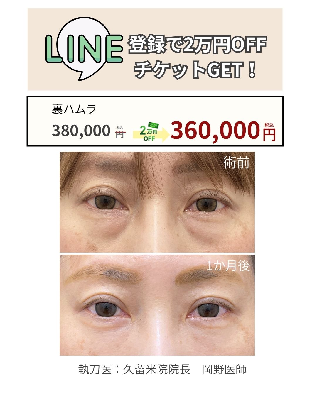 くまとりも２万円OFF！！