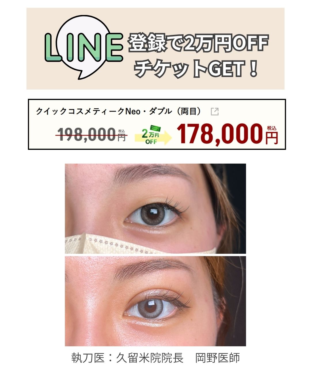 二重施術が２万円OFF！！