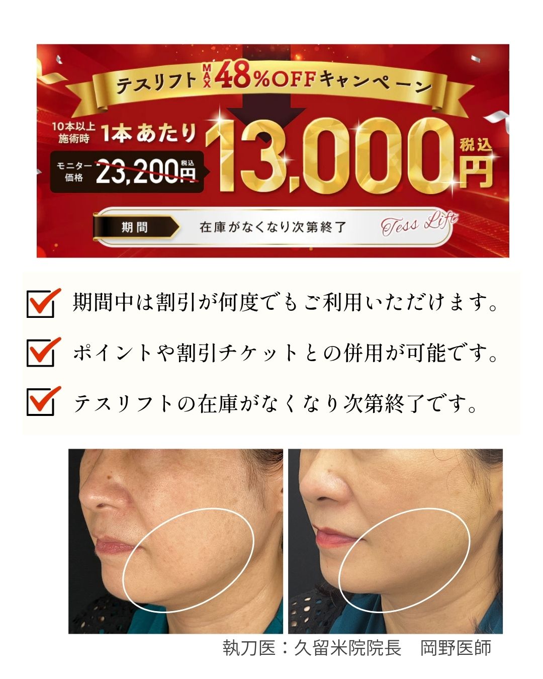 テスリフトが48%OFF！？