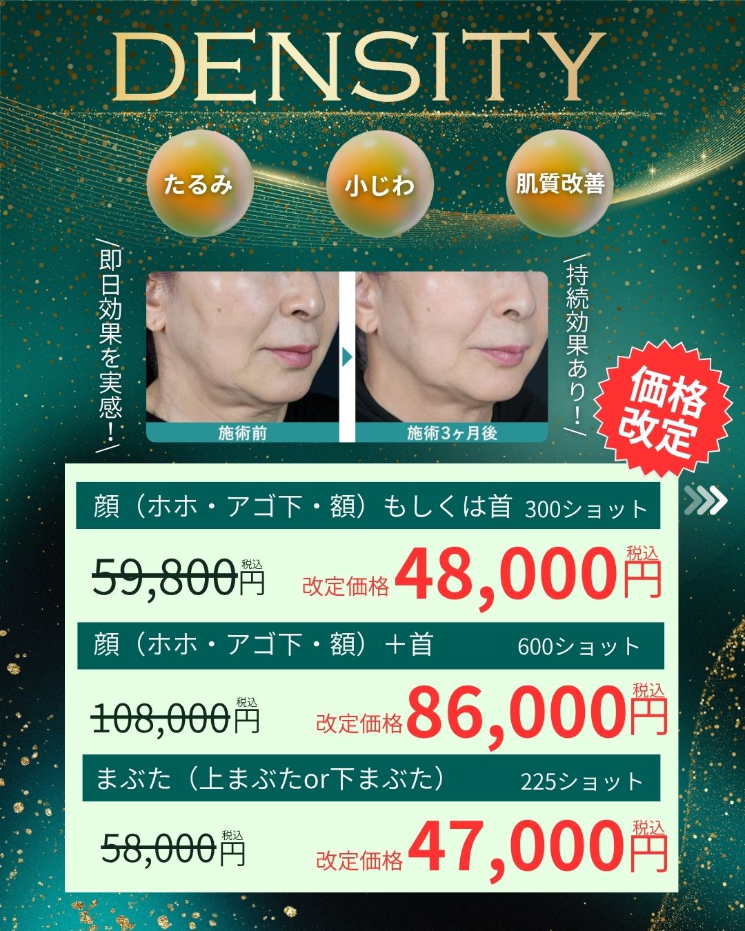 たるみ改善!人気施術✨