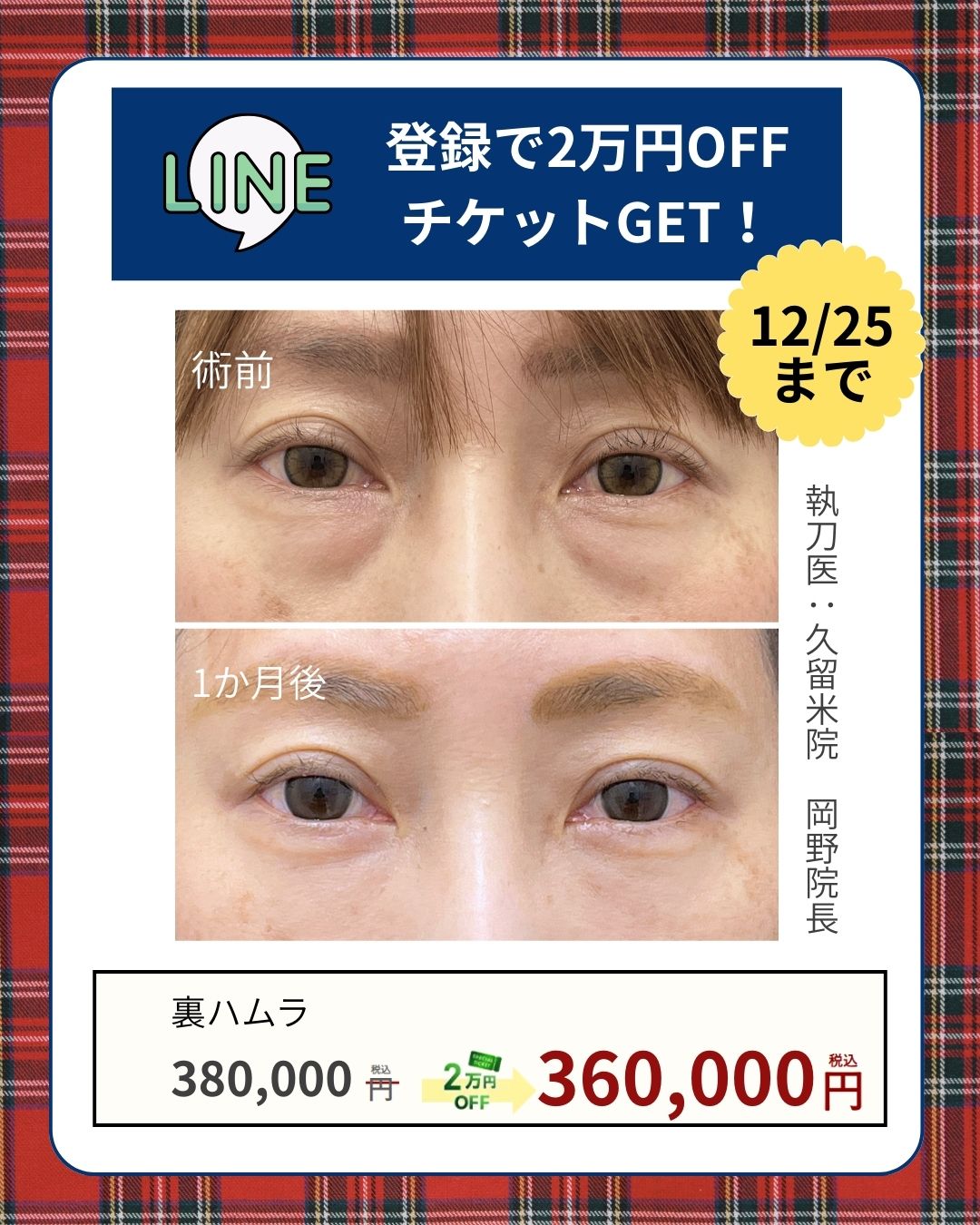 12月25日クリスマス目で！🚨