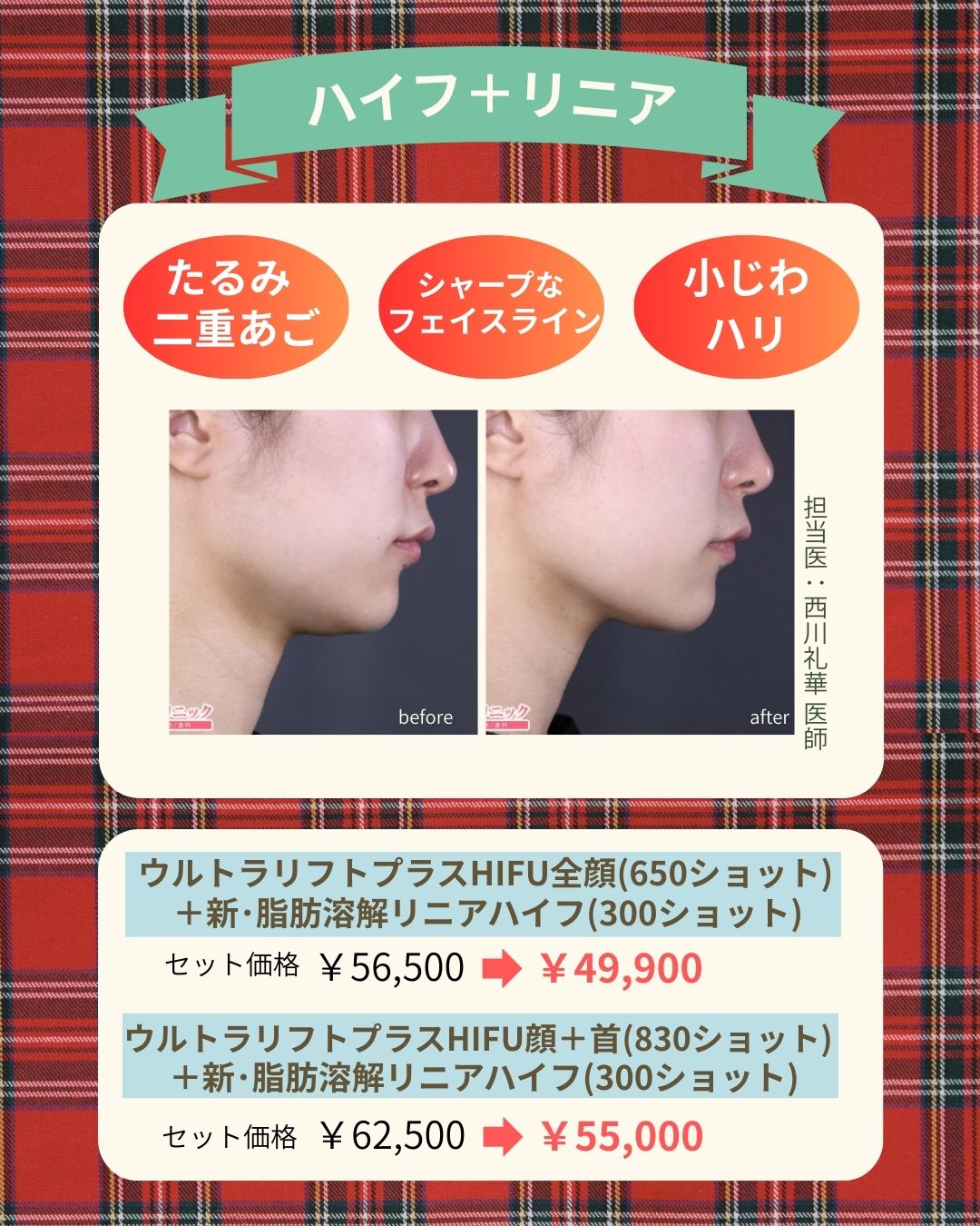 脂肪溶解×リフトアップ❤️‍🔥