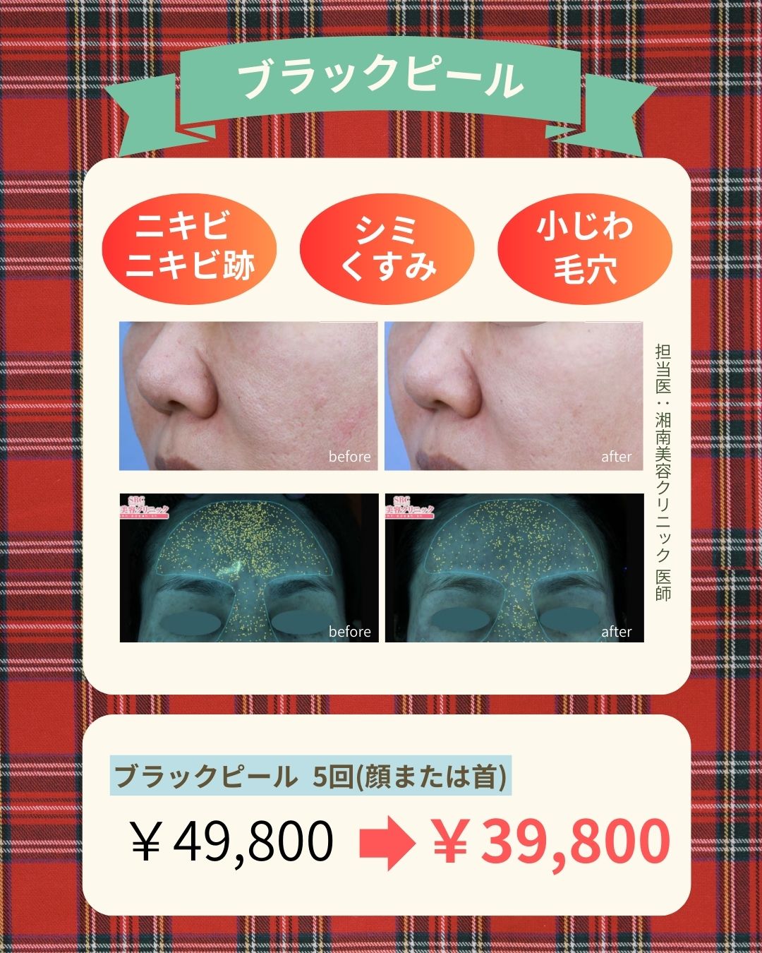 即日トーンアップ！