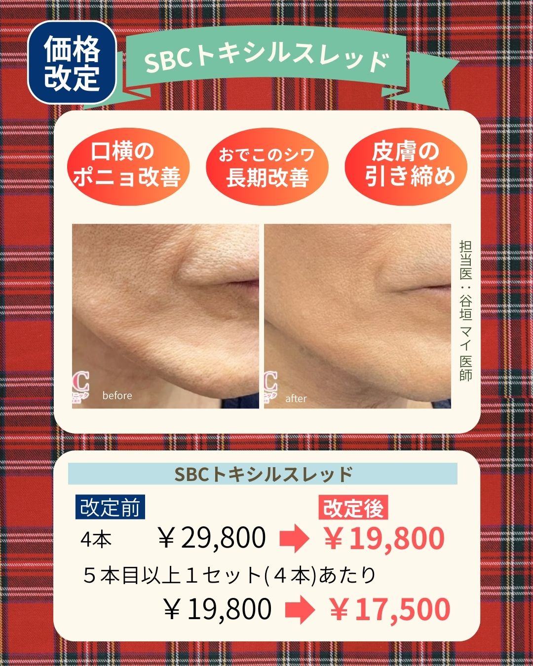 おでこのシワ・ポニョ撃退！