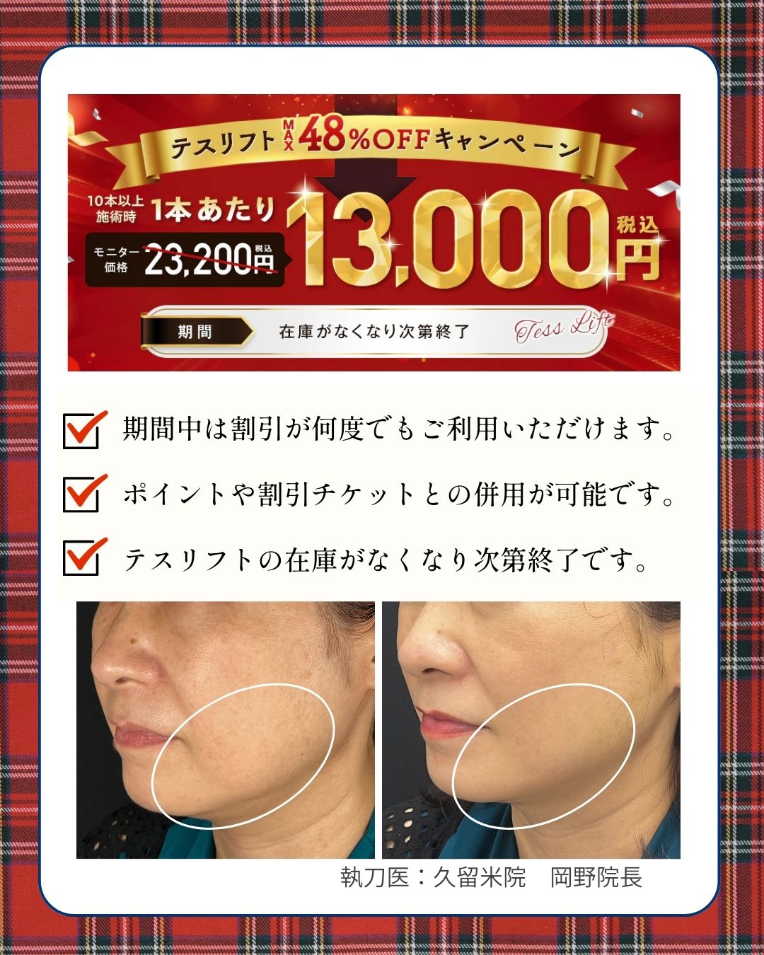 早い者勝ち！テスリフト！💨