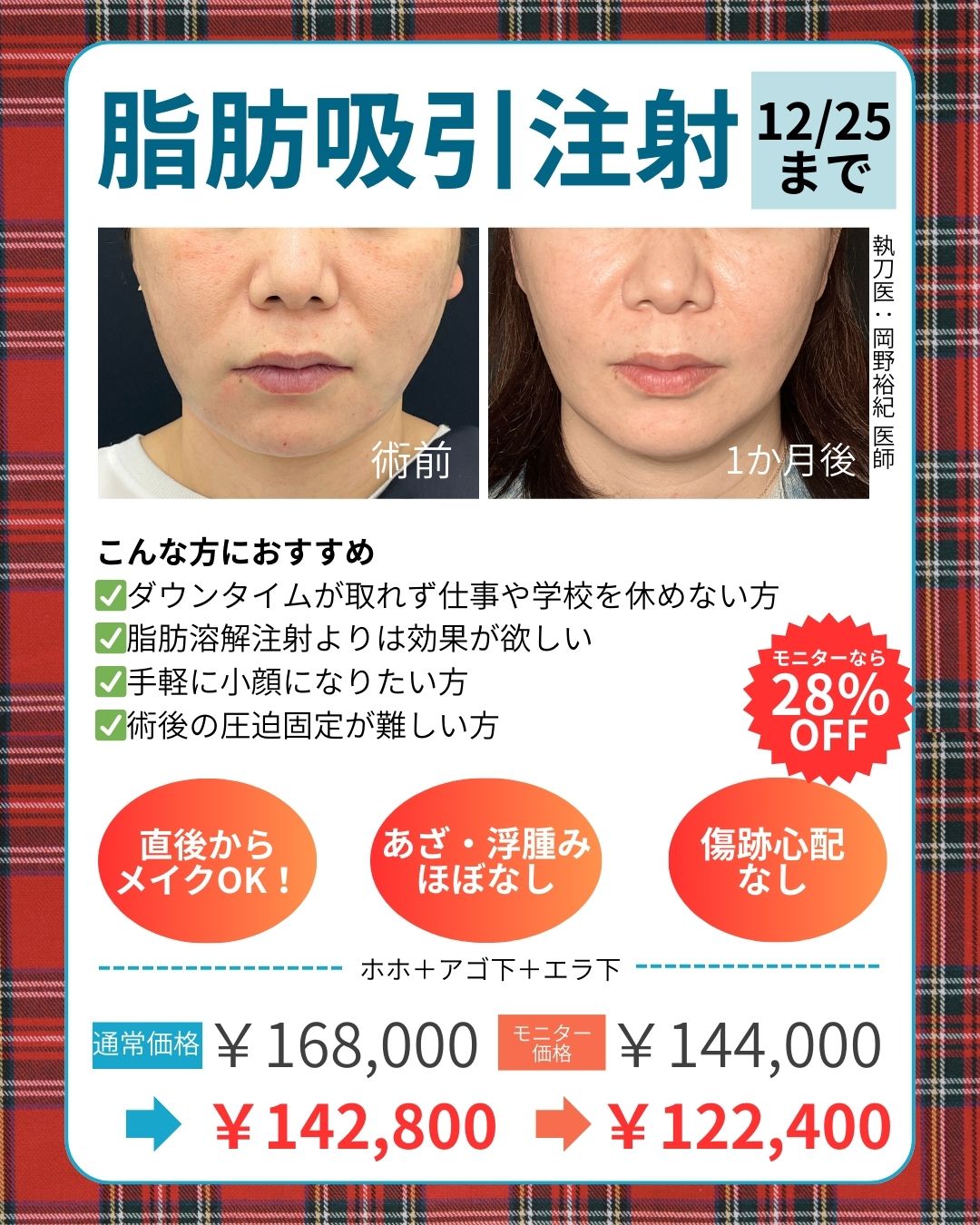 12月25日クリスマスまで！🚨