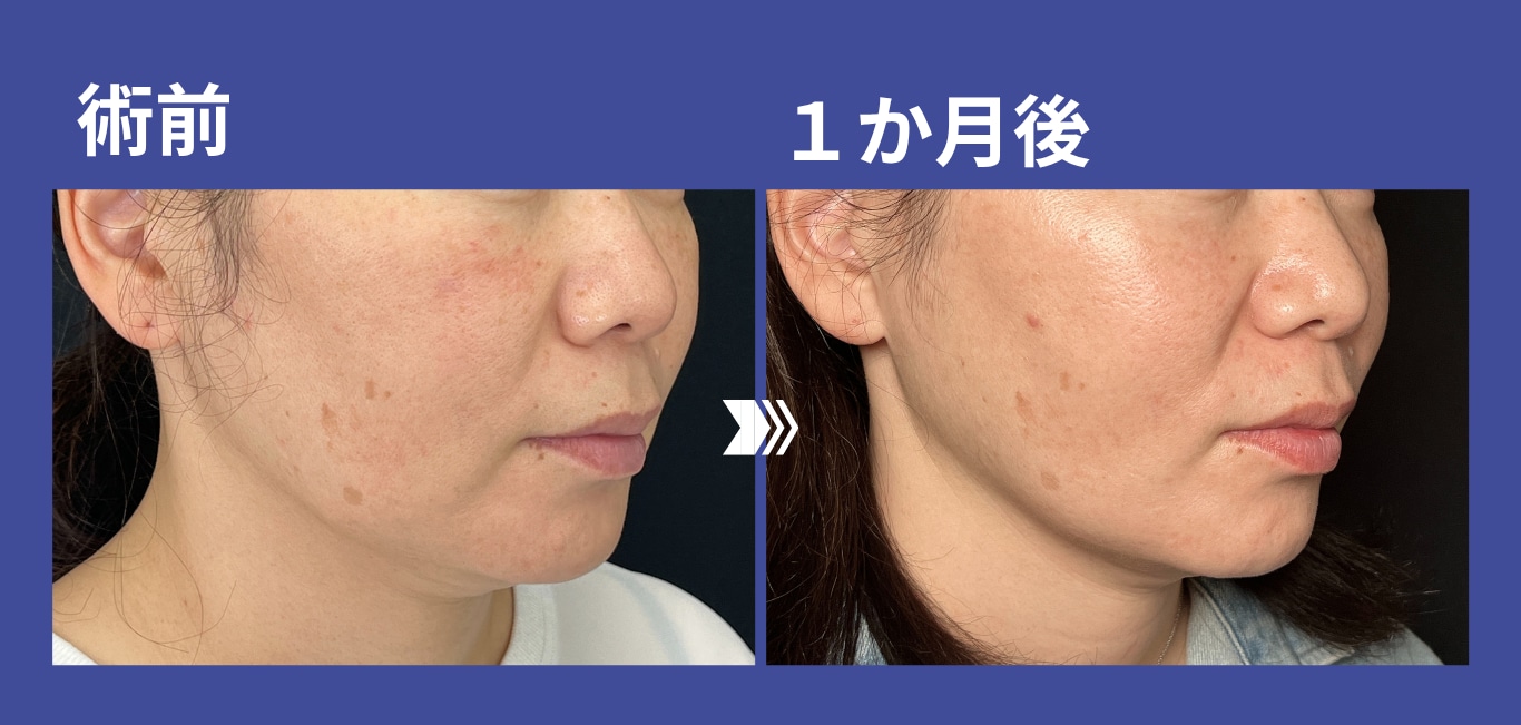 岡野院長の推し活リフト！🥰