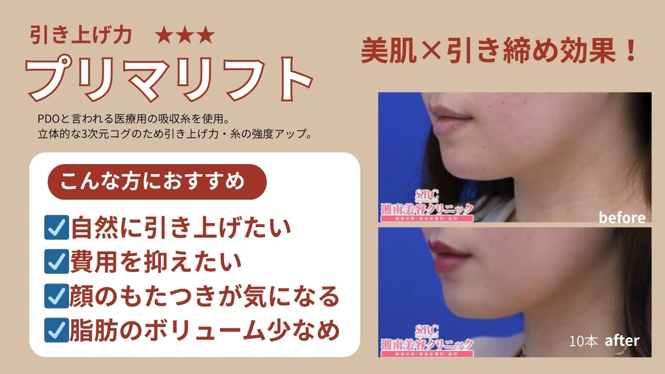 糸の種類と適応