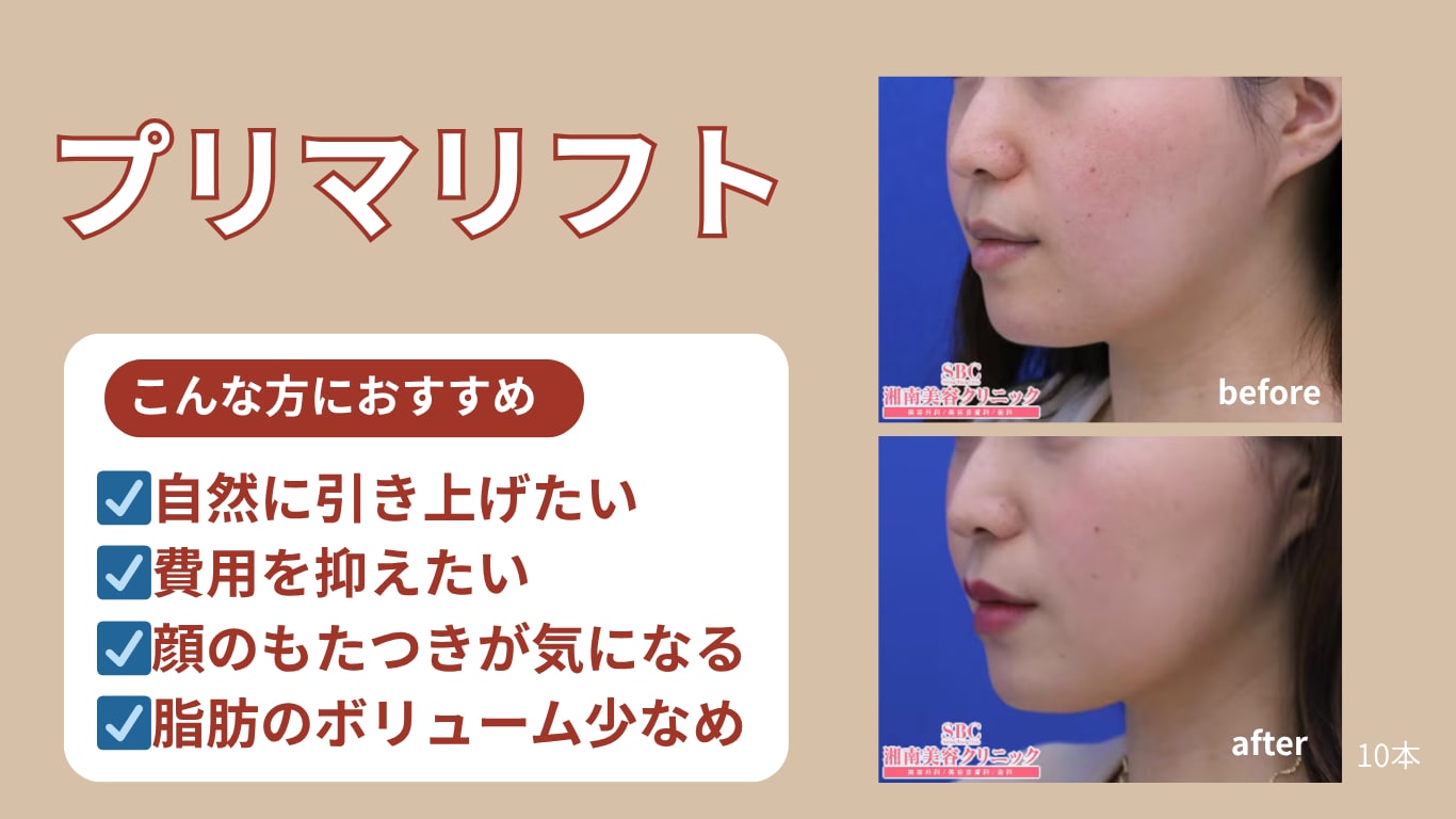 糸の種類と適応