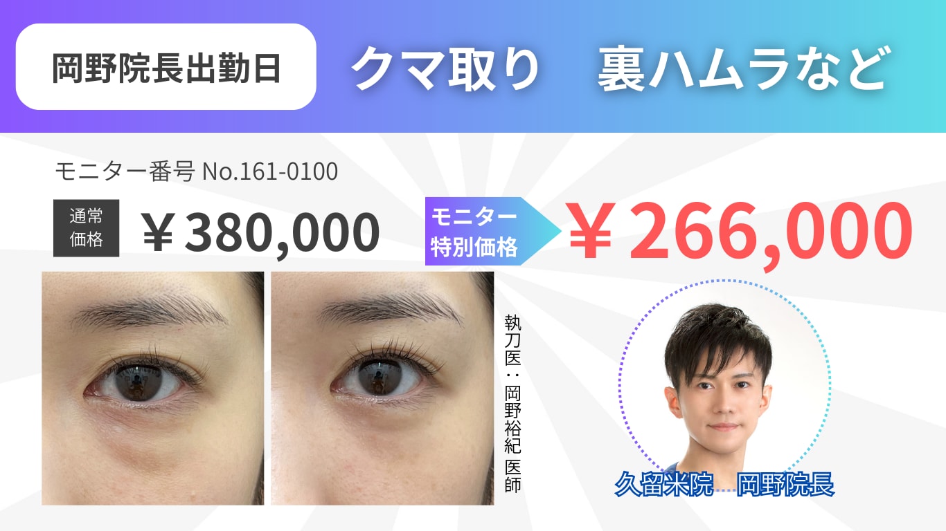 クマ取りモニター