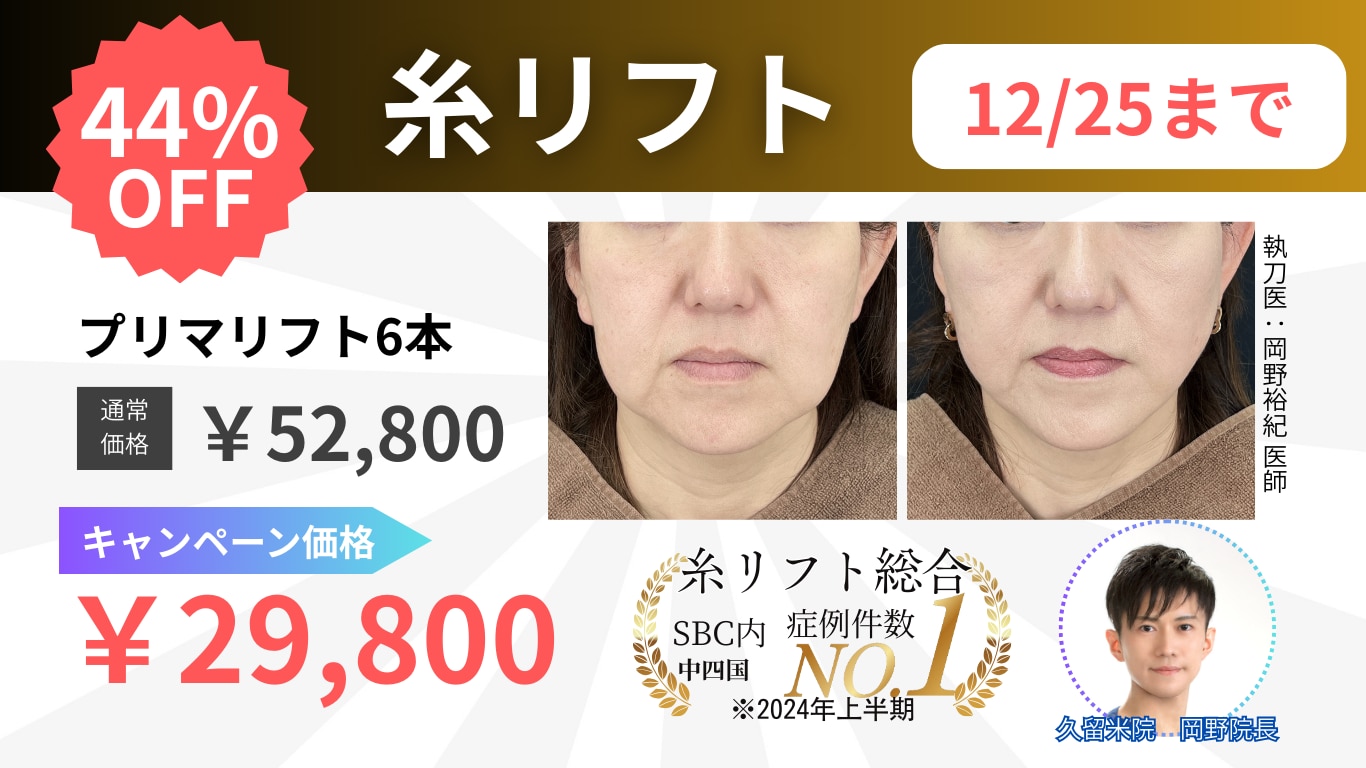 【期間限定】糸リフトキャンペーン