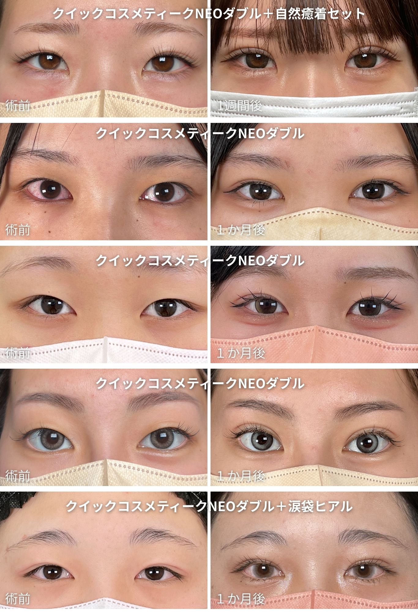 クイックコスメティークNEO