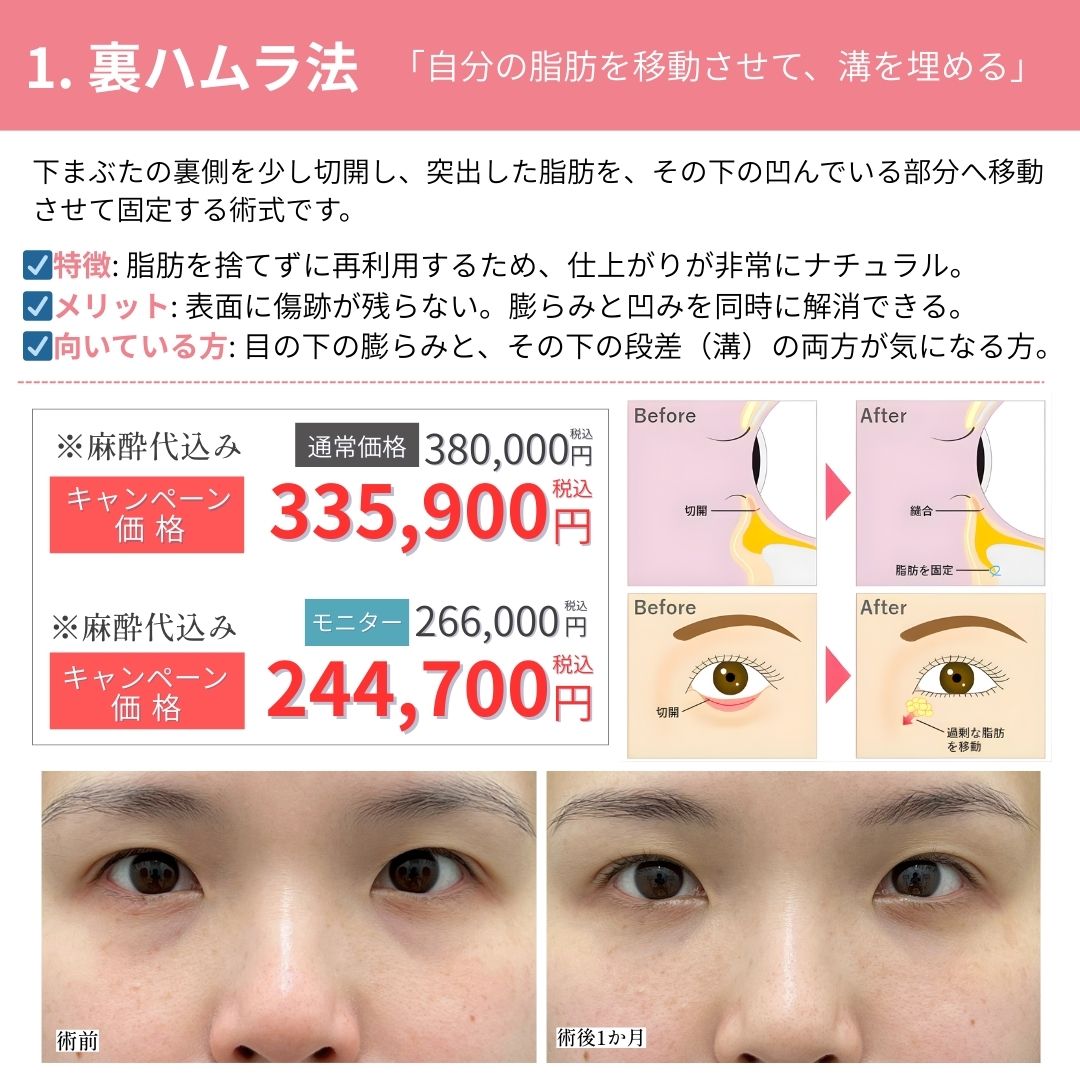 久留米院で人気のクマ取り２選！👑