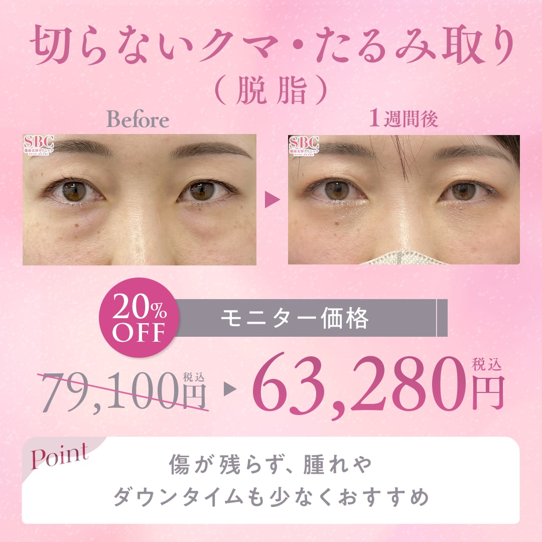 【新生活応援！第一弾🌸】クマ取り20％OFF！