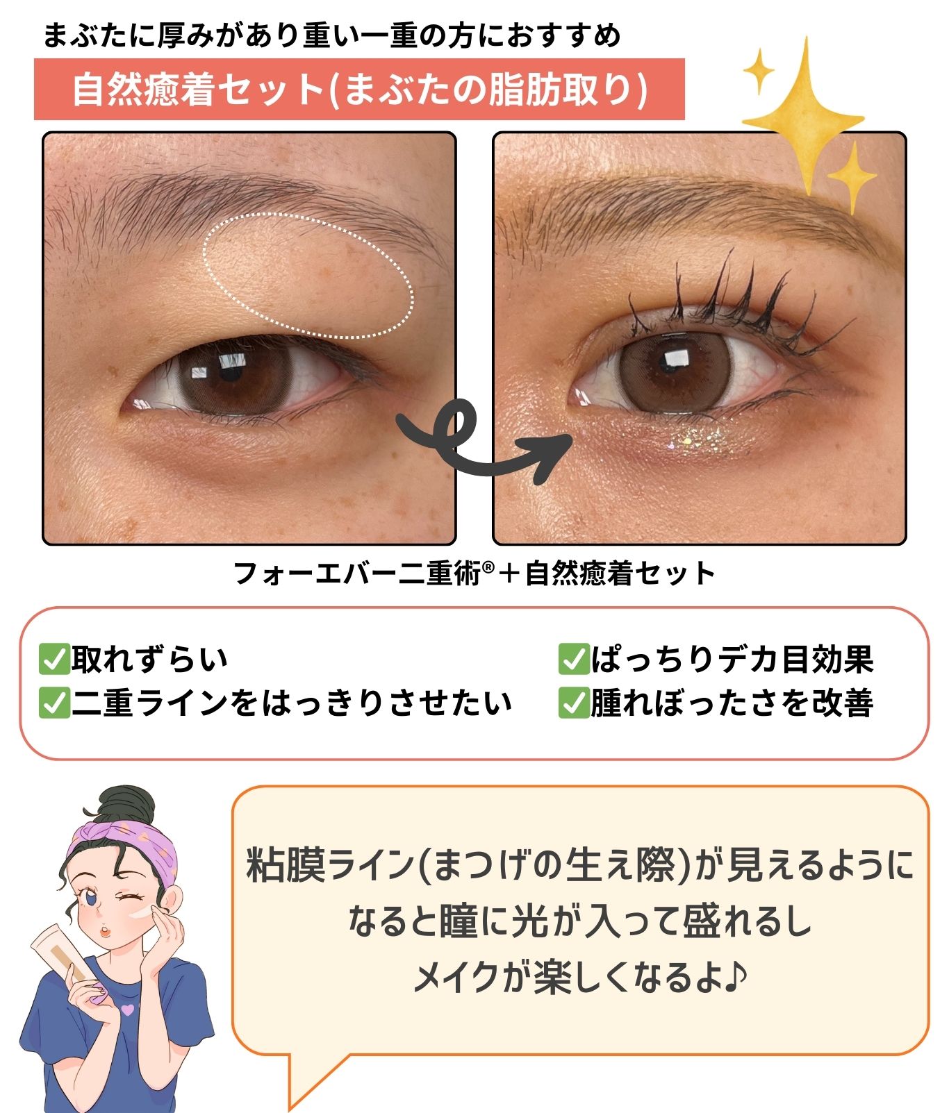 【さらに長持ち！】腫れぼったいまぶたの方必見！