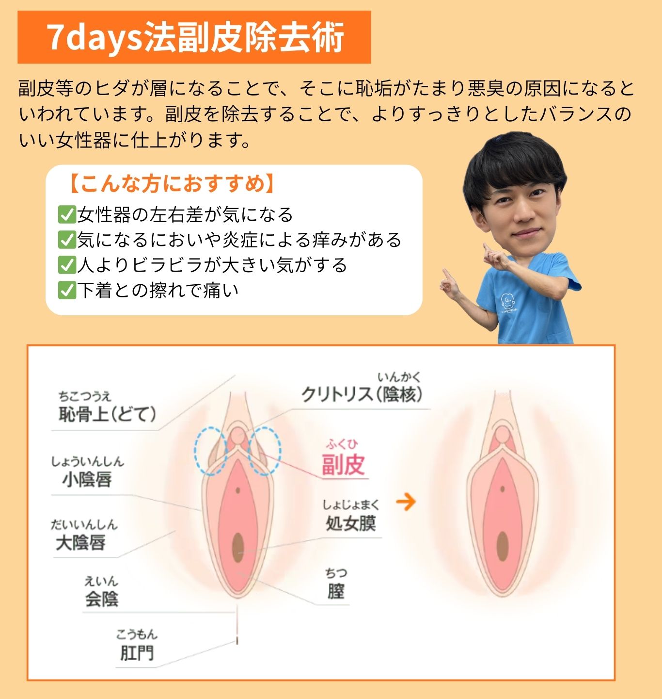 7days法副皮除去術とは？