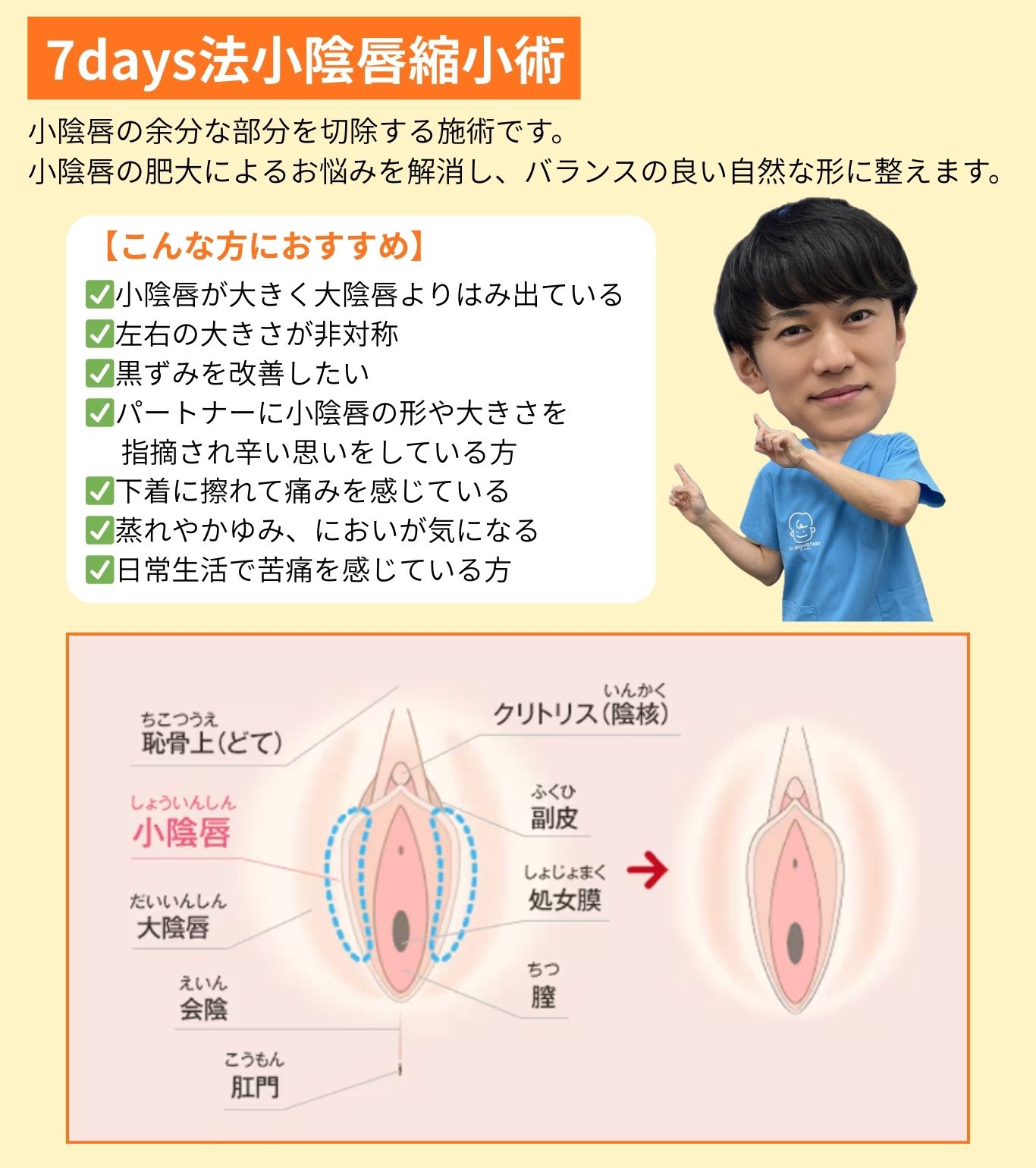 7days法小陰唇縮小術とは？