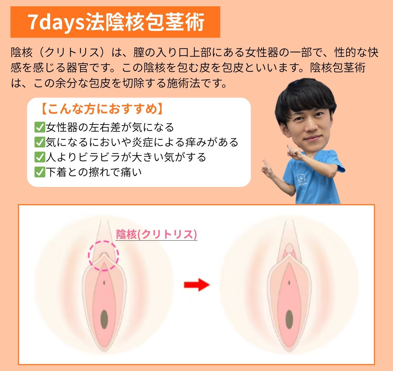 7days法陰核包茎術とは？