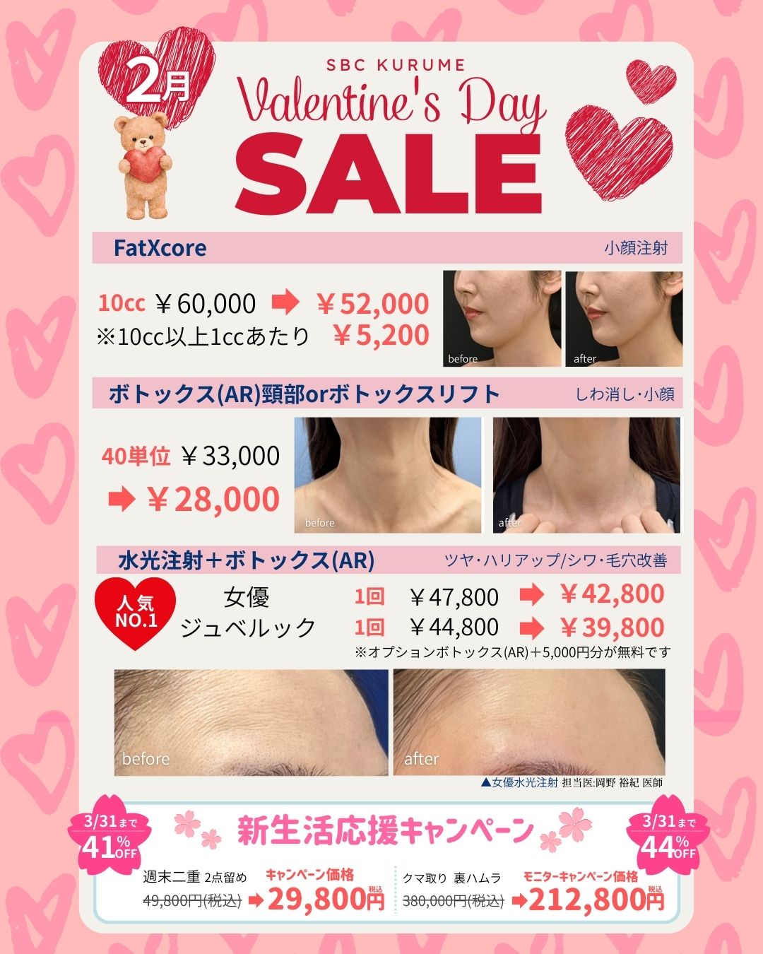 ２月も久留米院でお得に綺麗に！