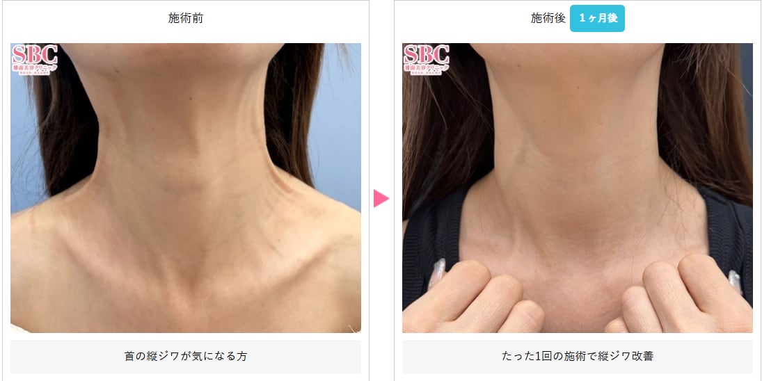 キュッと引き締める！