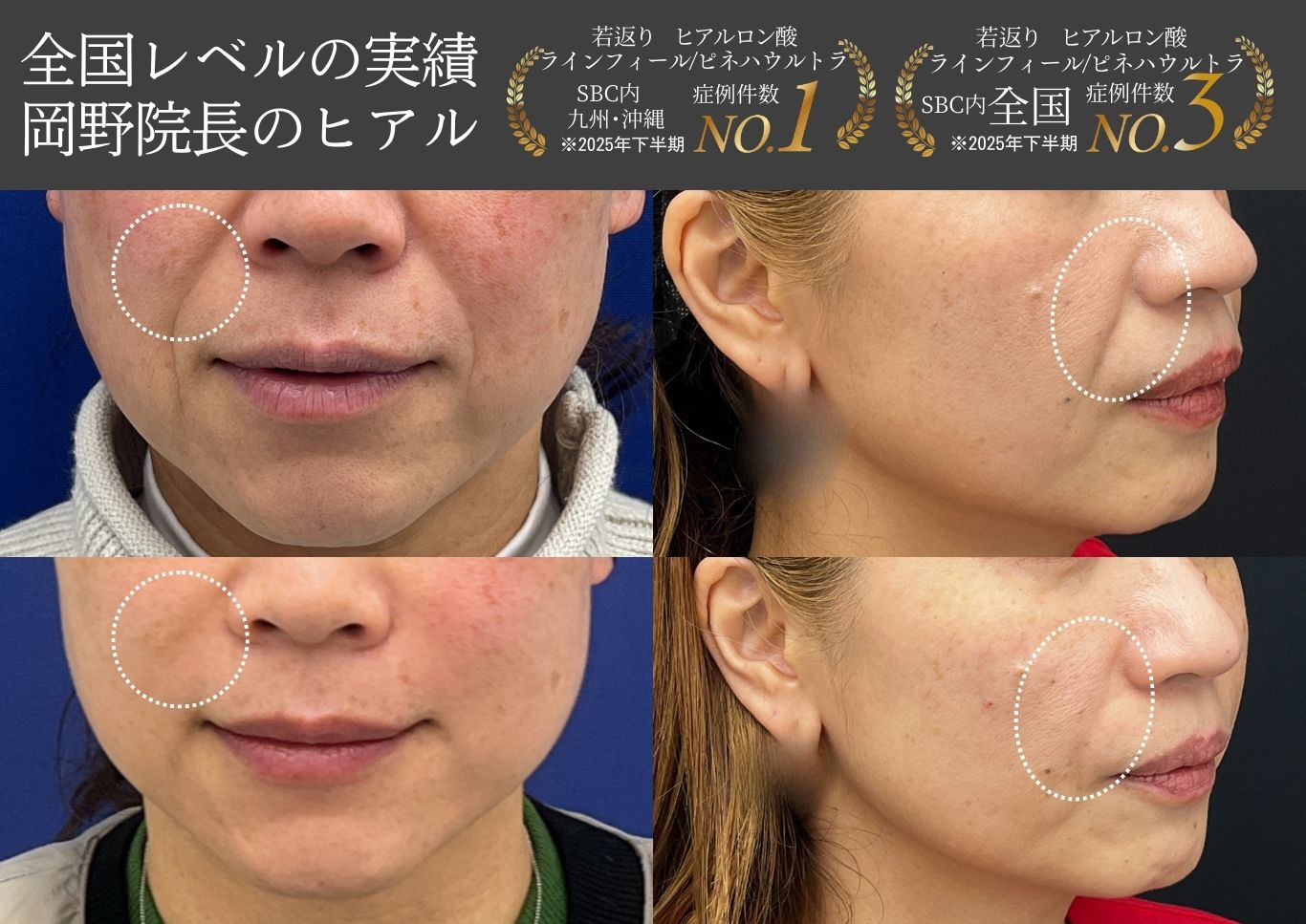 綺麗に自然な変化